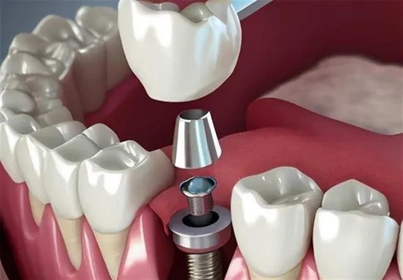 سلبریتی‌ها حق تبلیغ خدمات پزشکی را ندارند